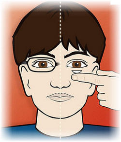 коррекции зрения, контактные линзы детям